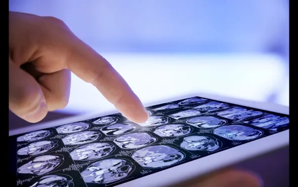Keeping up with cyber risks in AI-powered healthcare wearables